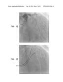 AUTOMATIC ANGIOGRAM DETECTION diagram and image