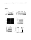 Methods to treat pancreatic inflammation and associated lung injury     through regulation of pancreatic interleukin-22 expression diagram and image