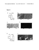 Methods to treat pancreatic inflammation and associated lung injury     through regulation of pancreatic interleukin-22 expression diagram and image