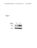 Methods to treat pancreatic inflammation and associated lung injury     through regulation of pancreatic interleukin-22 expression diagram and image