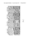 AUTOLOGOUS HUMAN ADULT PLURIPOTENT VERY SMALL EMBRYONIC-LIKE (hVSEL) STEM     CELL REGENERATION OF BONE AND CARTILAGE diagram and image