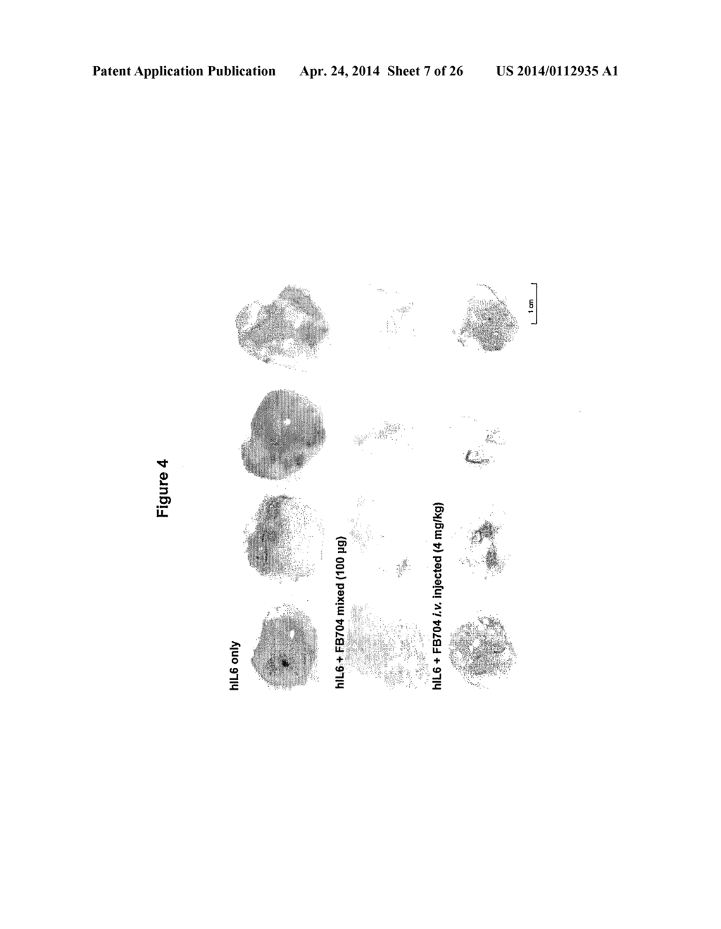 ANTIBODIES TO INTERLEUKIN-6 AND USE THEREOF - diagram, schematic, and image 08