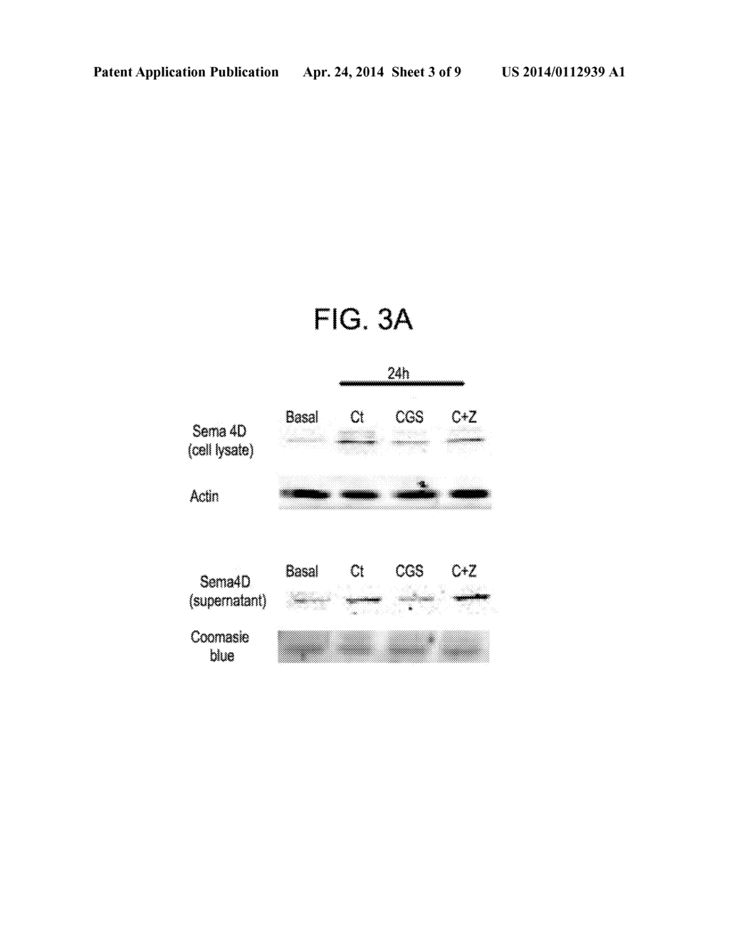 Methods for Inhibiting Osteolysis - diagram, schematic, and image 04