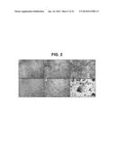 METHODS OF MODULATING BONE REMODELING diagram and image