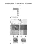 ASSESSMENT OF IRON DEPOSITION POST MYOCARDIAL INFARCTION AS A MARKER OF     MYOCARDIAL HEMORRHAGE diagram and image