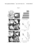 ASSESSMENT OF IRON DEPOSITION POST MYOCARDIAL INFARCTION AS A MARKER OF     MYOCARDIAL HEMORRHAGE diagram and image