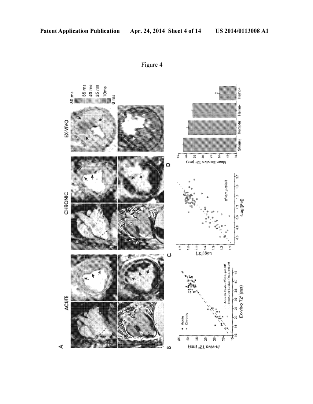 ASSESSMENT OF IRON DEPOSITION POST MYOCARDIAL INFARCTION AS A MARKER OF     MYOCARDIAL HEMORRHAGE - diagram, schematic, and image 05