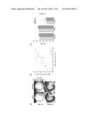 ASSESSMENT OF IRON DEPOSITION POST MYOCARDIAL INFARCTION AS A MARKER OF     MYOCARDIAL HEMORRHAGE diagram and image