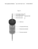 ASSESSMENT OF IRON DEPOSITION POST MYOCARDIAL INFARCTION AS A MARKER OF     MYOCARDIAL HEMORRHAGE diagram and image