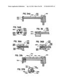 Systems and Methods for Applying Texture Material to Ceiling Surfaces diagram and image