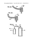 Systems and Methods for Applying Texture Material to Ceiling Surfaces diagram and image