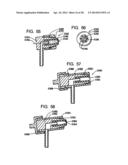 Systems and Methods for Applying Texture Material to Ceiling Surfaces diagram and image