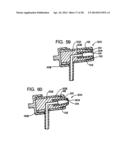 Systems and Methods for Applying Texture Material to Ceiling Surfaces diagram and image