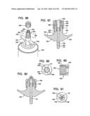 Systems and Methods for Applying Texture Material to Ceiling Surfaces diagram and image