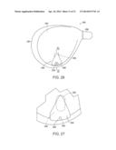 Golf Club Having Removable Weight diagram and image