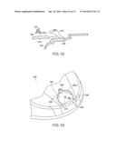 Golf Club Having Removable Weight diagram and image