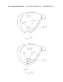 Golf Club Having Removable Weight diagram and image