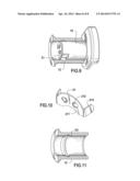 TENSIONER diagram and image