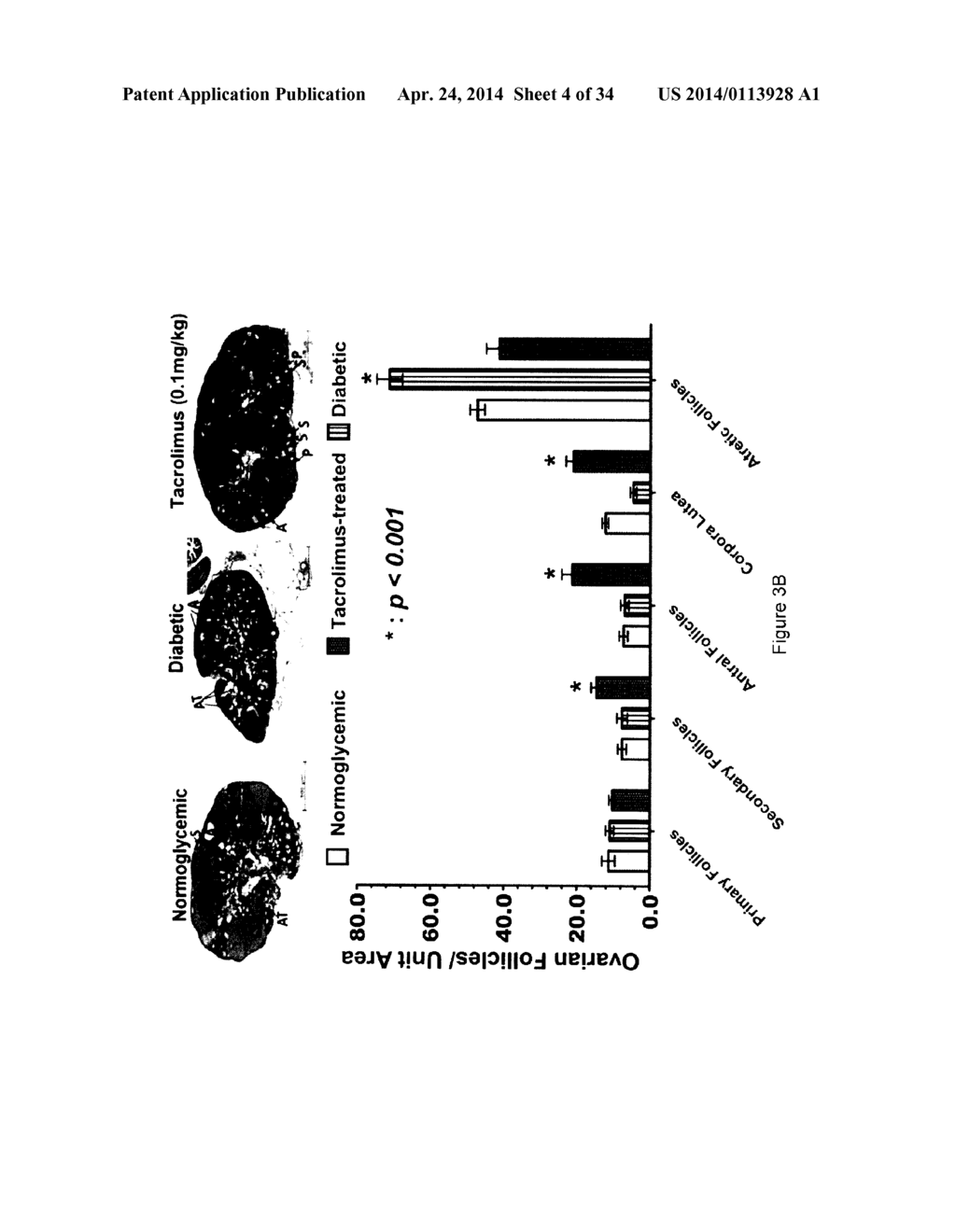 METHODS AND COMPOSITIONS FOR ENHANCING FERTILITY AND/OR INHIBITING     PREGNANCY FAILURE AND RESTORING GLUCOSE TOLERANCE - diagram, schematic, and image 05