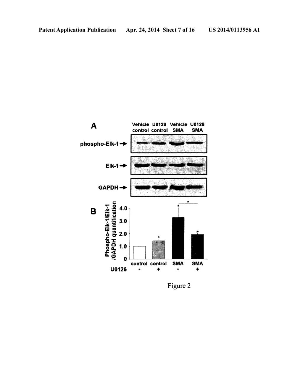 ERK INHIBITORS FOR USE IN TREATING SPINAL MUSCULAR ATROPHY - diagram, schematic, and image 08