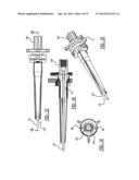 Tissue Retractor diagram and image