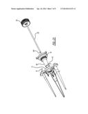 Tissue Retractor diagram and image