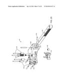 Retractor diagram and image