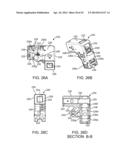 Retractor diagram and image