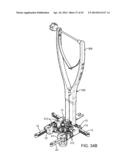 Retractor diagram and image