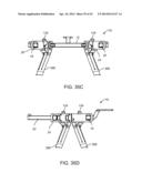 Retractor diagram and image