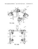 Retractor diagram and image