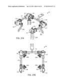 Retractor diagram and image