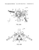 Retractor diagram and image