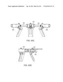 Retractor diagram and image