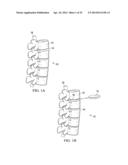 RETRACTOR DEVICE AND METHOD diagram and image