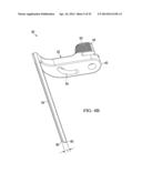 RETRACTOR DEVICE AND METHOD diagram and image