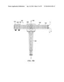 RETRACTOR DEVICE AND METHOD diagram and image