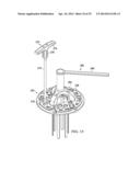 RETRACTOR DEVICE AND METHOD diagram and image