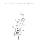 SYSTEMS AND METHODS FOR ASSESSING VASCULATURE HEALTH AND BLOOD CLOTS diagram and image