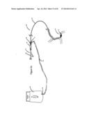 SYSTEMS AND METHODS FOR ASSESSING VASCULATURE HEALTH AND BLOOD CLOTS diagram and image