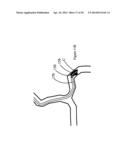 SYSTEMS AND METHODS FOR ASSESSING VASCULATURE HEALTH AND BLOOD CLOTS diagram and image