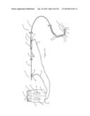 SYSTEMS AND METHODS FOR ASSESSING VASCULATURE HEALTH AND BLOOD CLOTS diagram and image