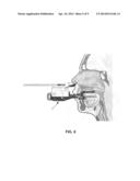 DIAGNOSTIC DEVICES, MANDIBULAR MANIPULATORS WITH TONGUE AND NASAL SENSORS,     AUTOMATED MANDIBULAR MANIPULATORS AND RELATED METHODS diagram and image