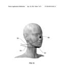 DIAGNOSTIC DEVICES, MANDIBULAR MANIPULATORS WITH TONGUE AND NASAL SENSORS,     AUTOMATED MANDIBULAR MANIPULATORS AND RELATED METHODS diagram and image