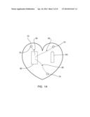 Patient-Readable Portable Cardiac Monitor diagram and image