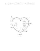 Patient-Readable Portable Cardiac Monitor diagram and image