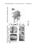 METHOD AND SYSTEM FOR DETECTION OF BIOLOGICAL RHYTHM DISORDERS diagram and image