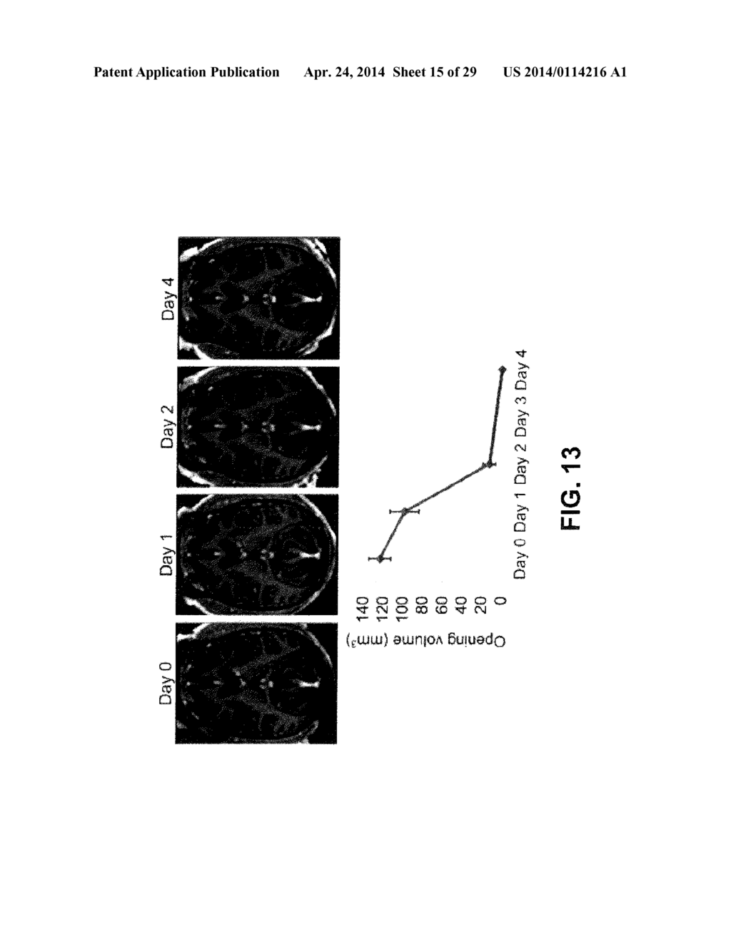 SYSTEMS AND METHODS FOR OPENING OF A TISSUE BARRIER IN PRIMATES - diagram, schematic, and image 16