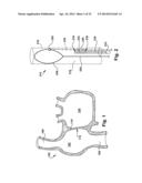 APPARATUS AND METHOD FOR TARGETING A BODY TISSUE diagram and image