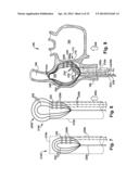 APPARATUS AND METHOD FOR TARGETING A BODY TISSUE diagram and image